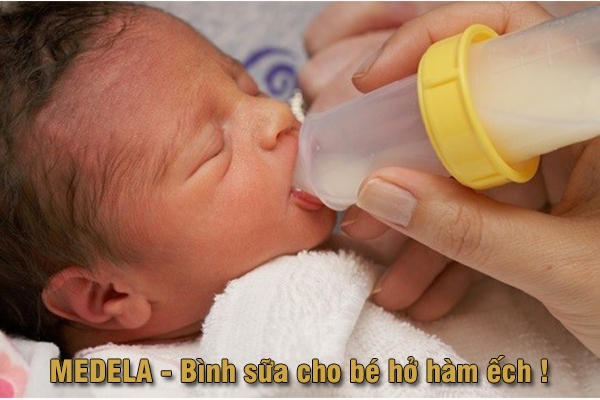 Bình sữa Medela cho trẻ hở hàm ếch giải pháp hiệu quả tuyệt vời cho bé
