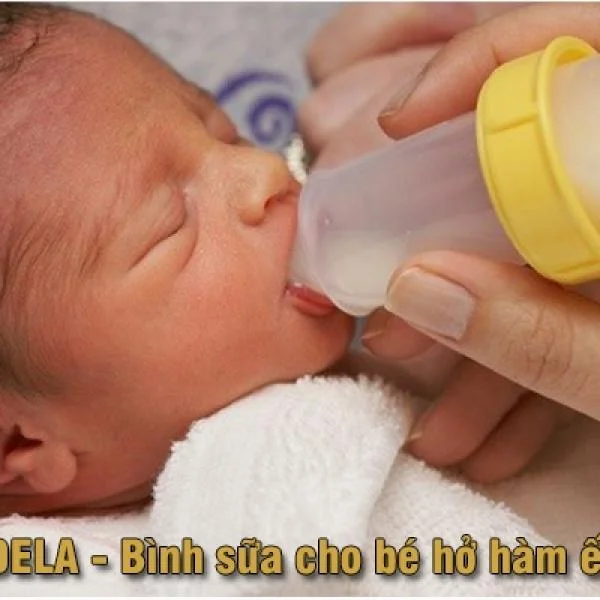 Bình sữa Medela cho trẻ hở hàm ếch giải pháp hiệu quả tuyệt vời cho bé