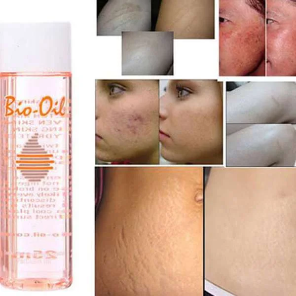 dau-tri-ran-da-bio-oil-7